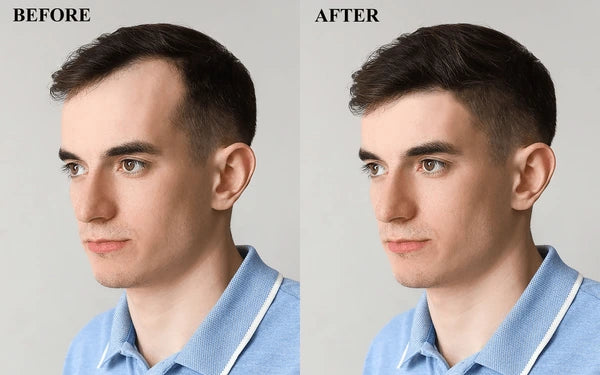 ELIXIR CRECIMIENTO CAPILAR - !RECUPERA TU CABELLO!