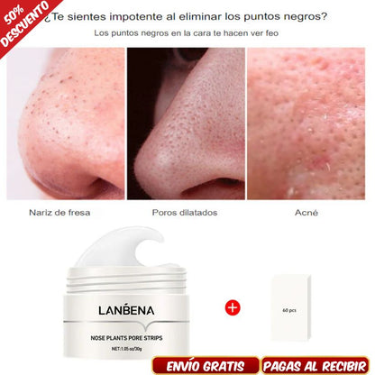 LANBENA CREMA - REMOVEDOR PUNTOS NEGROS